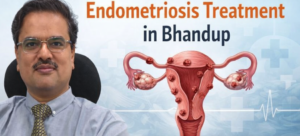 Endometriosis Treatment in Bhandup