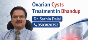 Ovarian Cysts Treatment in Bhandup